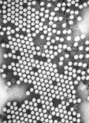 A TEM micrograph of poliovirus