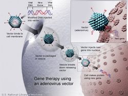 Gene therapy using an Adenovirus vector. A new gene is  inserted into an adenovirus vector, which is used to introduce the modified DNA into a human cell. If the treatment is successful, the new gene will make a functional protein.