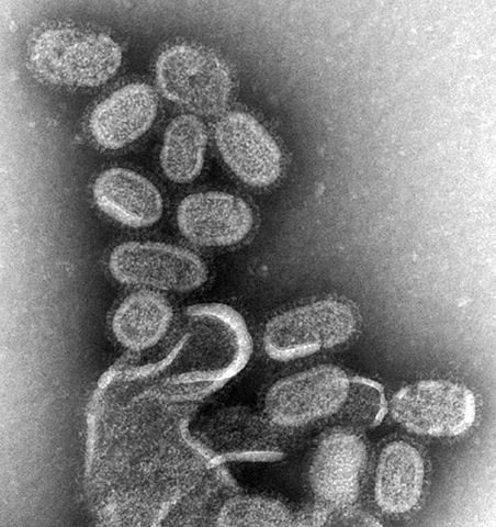 Image:EM of influenza virus.jpg