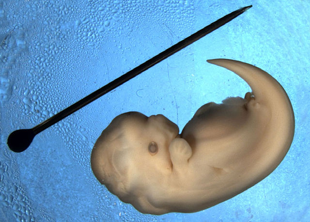 Image:Dolphin embryo.jpg