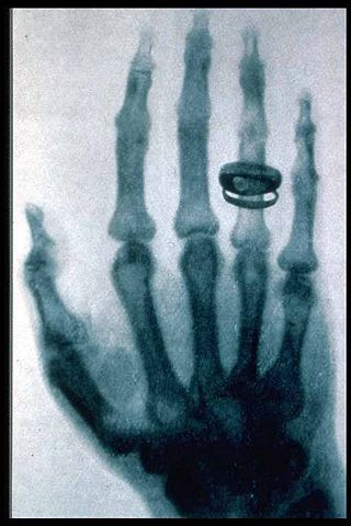 Image:Roentgen-x-ray-von-kollikers-hand.jpg