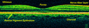 OCT scan of a retina at 800nm with an axial resolution of 3µm