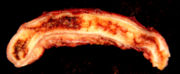 An acutely inflamed and enlarged appendix, sliced lengthwise