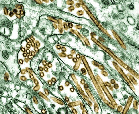 Image:Colorized transmission electron micrograph of Avian influenza A H5N1 viruses.jpg