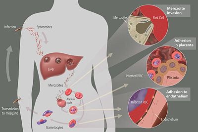 The life cycle of malaria parasites in the human body. A mosquito infects a pregnant woman, first in the liver and then in the bloodstream. First, sporozoites enter the bloodstream, and migrate to the liver. They infect liver cells (hepatocytes), where they multiply into merozoites, rupture the liver cells, and escape back into the bloodstream. Then, the merozoites infect red blood cells (erythrocytes), where they develop into ring forms, then trophozoites (a feeding stage), then multinucleated schizonts (a reproduction stage), then merozoites again. The merozoites rupture the blood cells and return to the bloodstream to infect more blood cells. Only the ring forms circulate in the bloodstream; the other red blood cells stick (adhere) to the walls (endothelium) of small blood vessels (venules), preventing the infected red blood cells from traveling to the spleen and being destroyed.