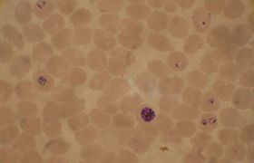 Blood smear from a P. falciparum culture (K1 strain). Several red blood cells have ring stages inside them. Close to the center there is a schizont and on the left a trophozoite.