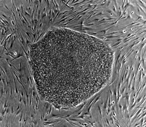 Human Embryonic Stem cell colony on mouse embryonic fibroblast feeder layer.