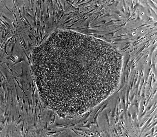 Image:Human embryonic stem cell colony phase.jpg