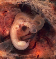 A human embryo at 5 weeks