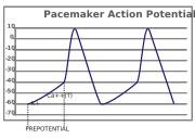 In pacemaker potentials, the cell spontaneously depolarizes (straight line with upward slope) until it fires an action potential.