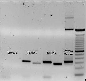 Figure 3: Ethidium bromide-stained PCR products after gel electrophoresis. Two sets of primers were used to amplify a target sequence from three different tissue samples. No amplification is present in sample #1; DNA bands in sample #2 and #3 indicate successful amplification of the target sequence. The gel also shows a positive control, and a DNA ladder containing DNA fragments of defined length for sizing the bands in the experimental PCRs.