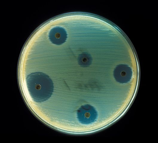 Image:Staphylococcus aureus (AB Test).jpg