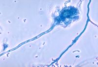 Aspergillus fumigatus - A common fungus which can lead to worsening lung disease in people with CF