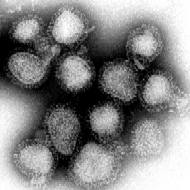 The influenza viruses that caused Hong Kong Flu. (magnified approximately 100,000 times)