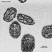 Electron micrograph of smallpox.