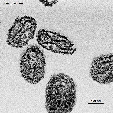 Image:EM smallpox, grown via tissue, isolate by centrifuge.jpg