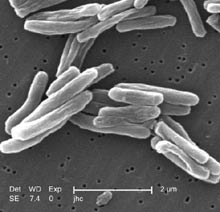 Scanning electron micrograph of Mycobacterium tuberculosis