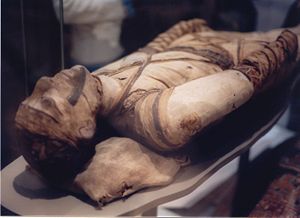Tubercular decay has been found in the spines of Egyptian mummies. Pictured: Egyptian mummy in the British Museum