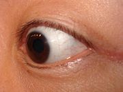 Contact lenses, other than the cosmetic variety, become almost invisible once inserted in the eye