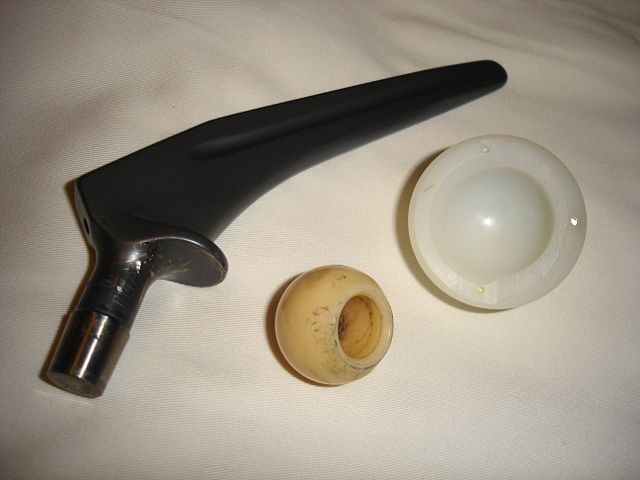 Image:Hip prosthesis.jpg