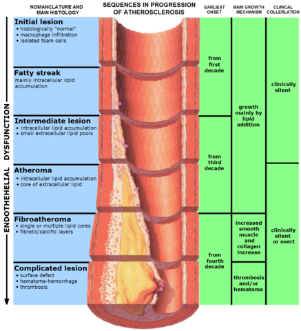 Image:Endo dysfunction Athero.PNG