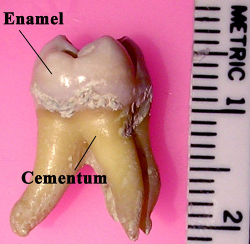 Image:Labeledmolar.jpg