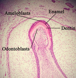 Histologic slide of developing hard tissues. Ameloblasts are forming enamel, while odontoblasts are forming dentin.