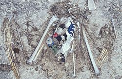 The remains of this Laysan Albatross chick show the plastic ingested before death, including a bottle cap and lighter.