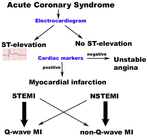 Image:ACS scheme.jpg