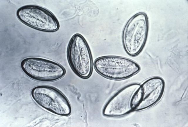 Image:Eggs of Enterobius vermicularis 5229 lores.jpg