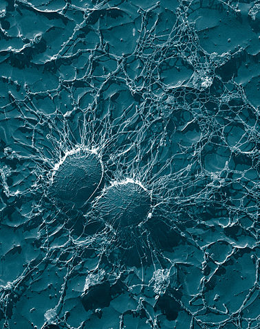 Image:Staphylococcus aureus, 50,000x, USDA, ARS, EMU.jpg